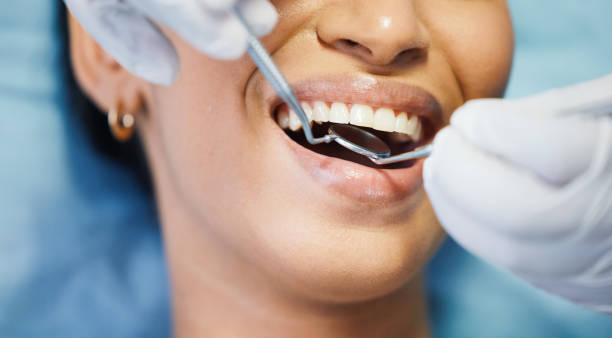 Best Emergency Denture Repair in Owensville, MO